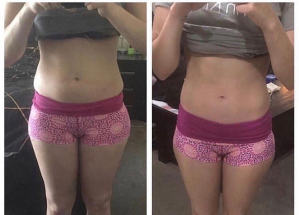 Fat freezing opening promotion one area