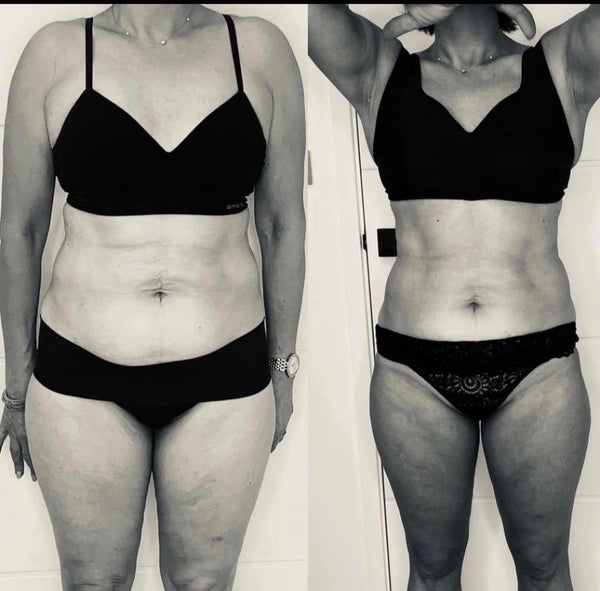 HIFU fat melting and magshape body toning package